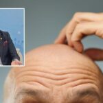 Kelligin caresi bulundu mu osman muftuoglu anlatti sac cikaran o seker wpS2mZ4d